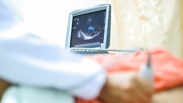 koronare-herzkrankheit-khk-1413257605-t