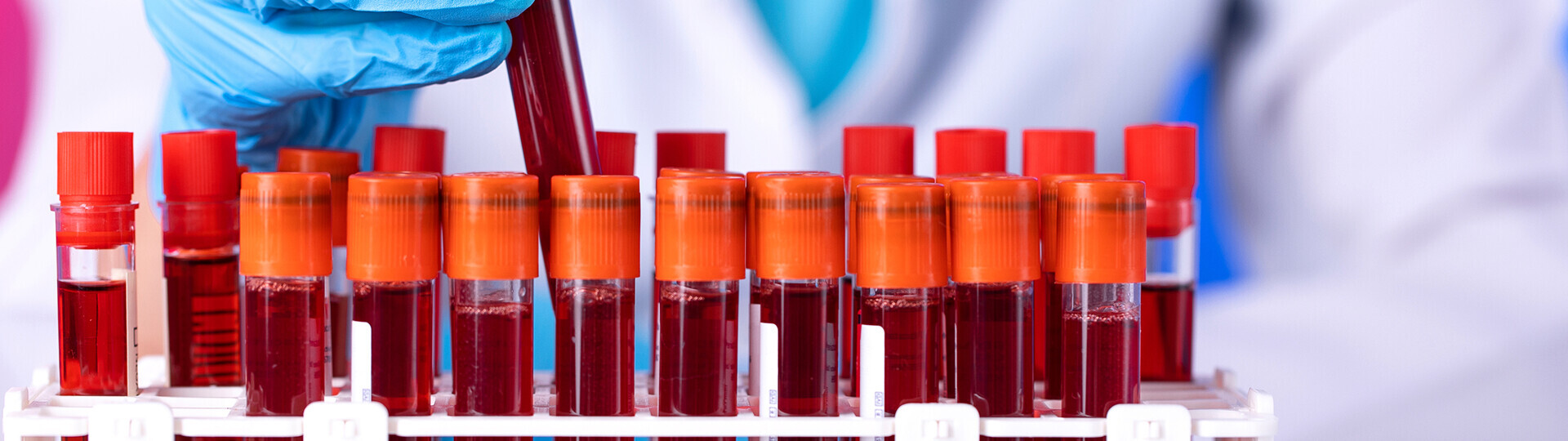 folgeerkrankungen-khk-blutwerte-22960268-h