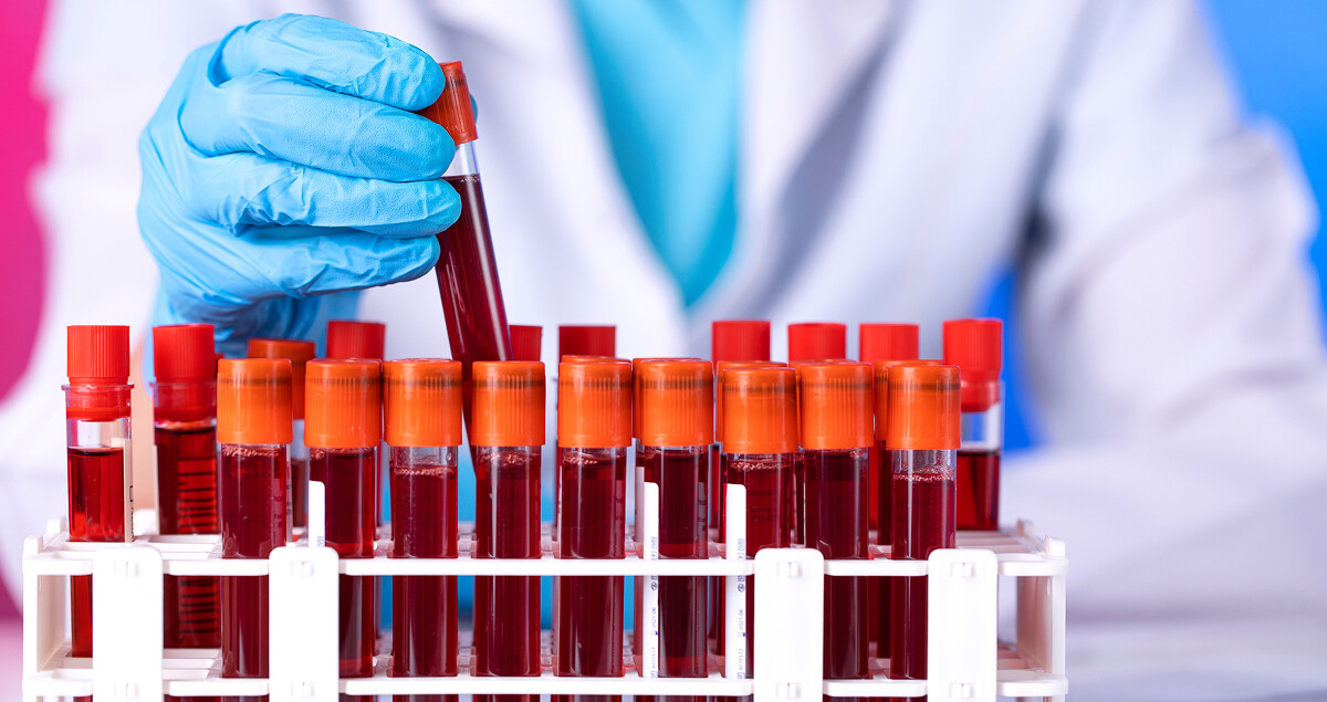 folgeerkrankungen-khk-blutwerte-22960268-sb