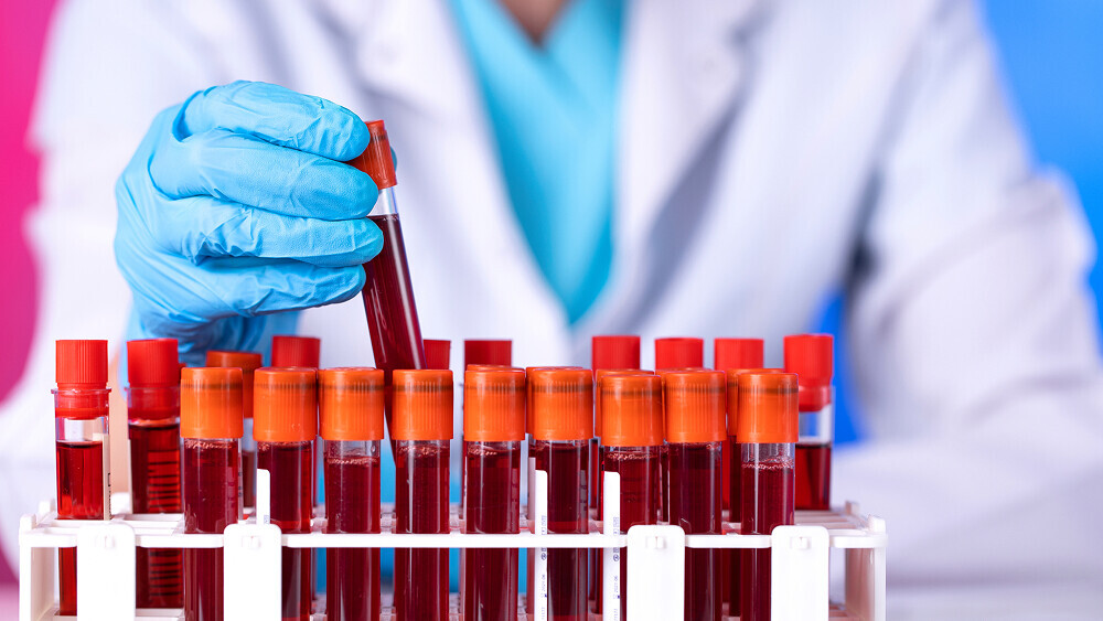 folgeerkrankungen-khk-blutwerte-22960268-t