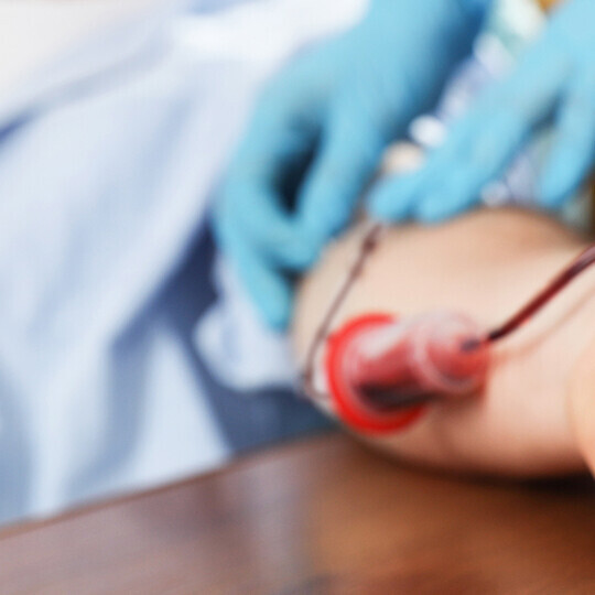 herzinfarkt-troponin-troponinwert-1590871012-h
