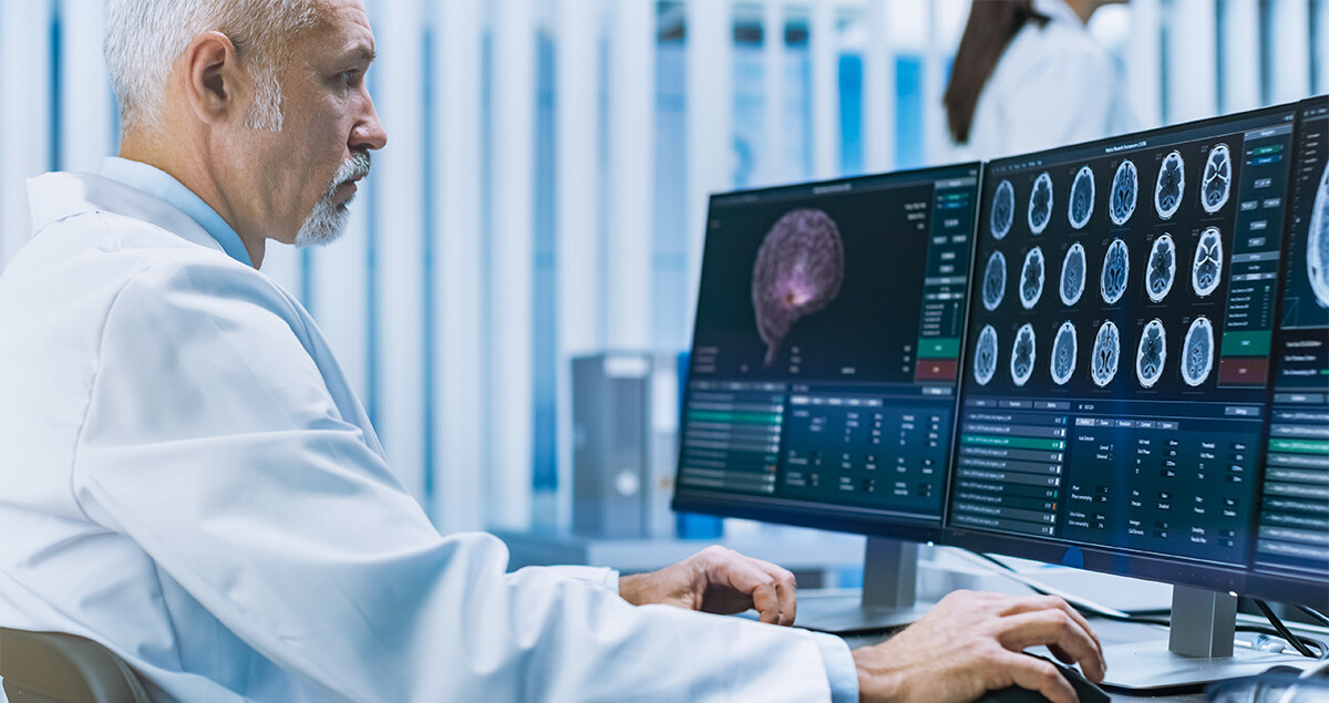 Herzinfarkt_Folgen_Gehirn-1197119998-s