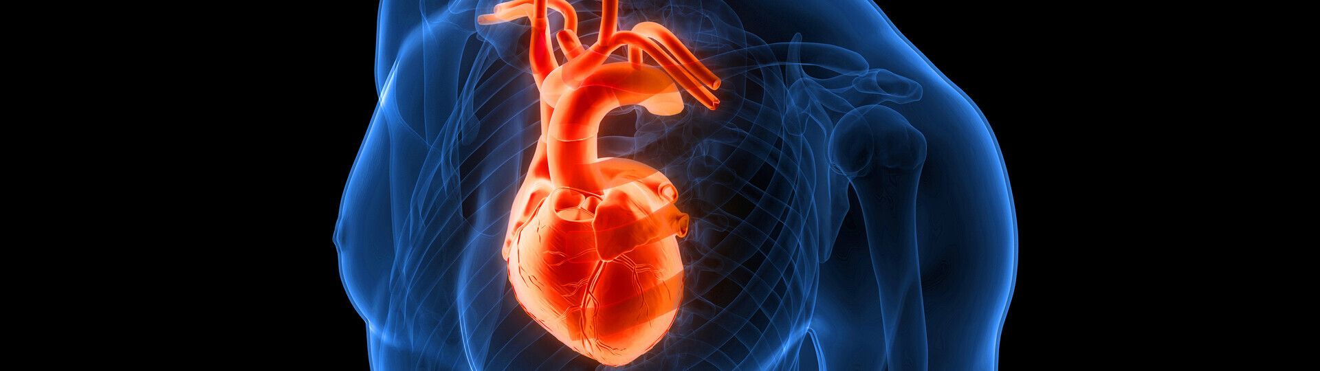 vorhofflimmern-ursachen-1432432524_H