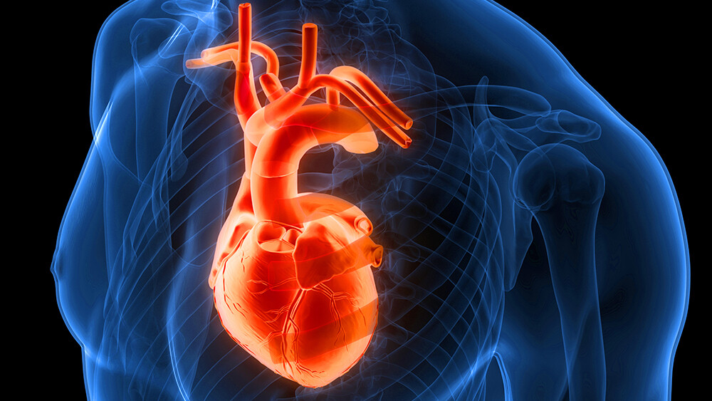 vorhofflimmern-ursachen-1432432524_T