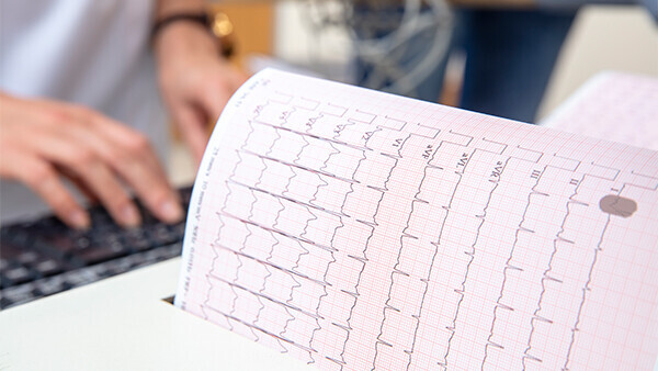 Wolff-Parkinson-White-Syndrom-1456572261-t