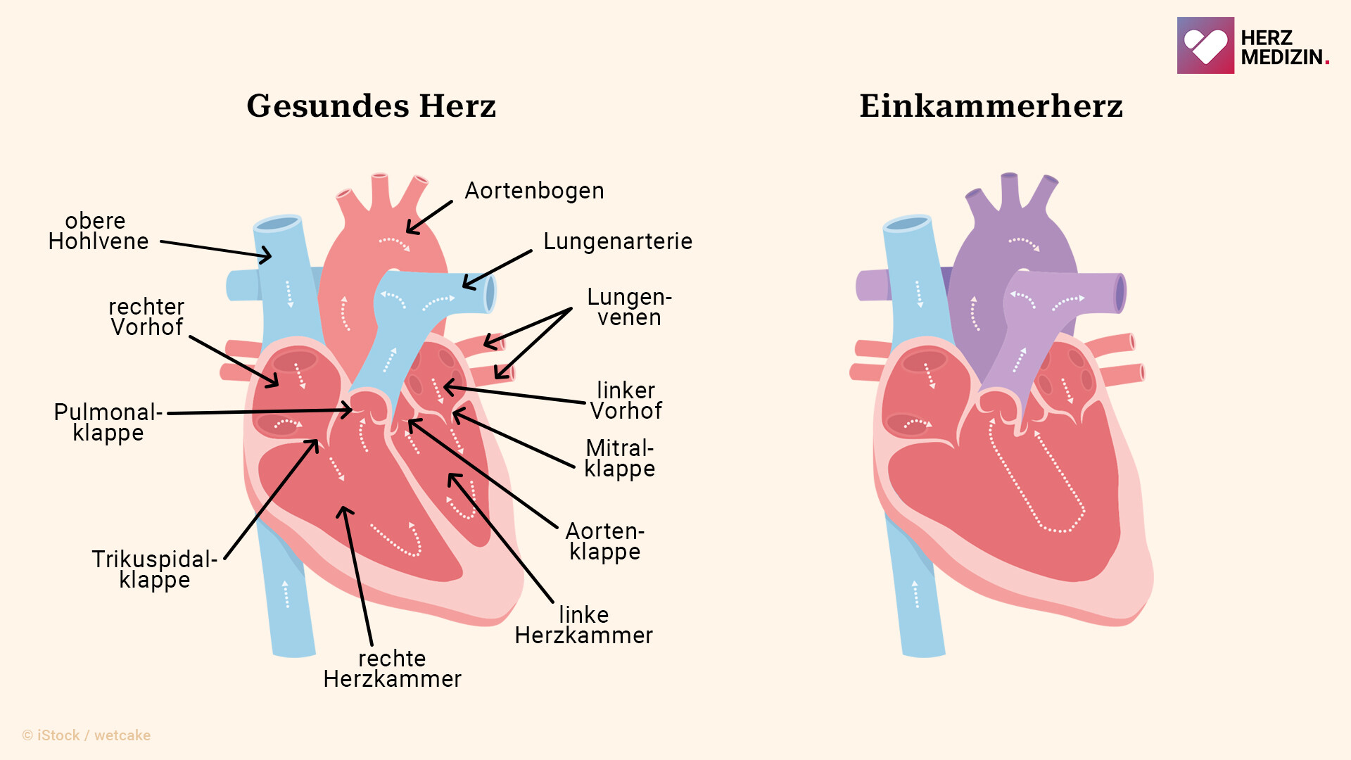 einkammerherz-grafik