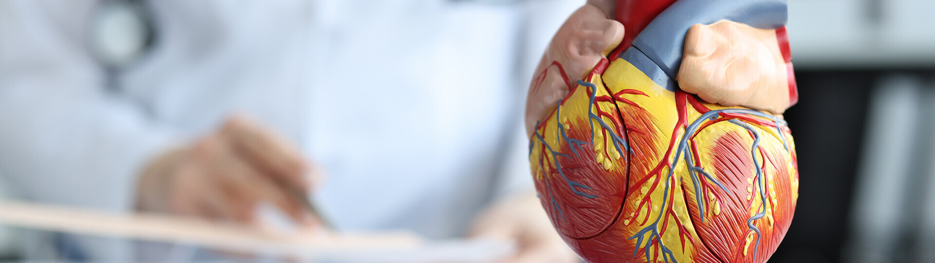 nicht-stenosierende-koronarsklerose-22420865-h