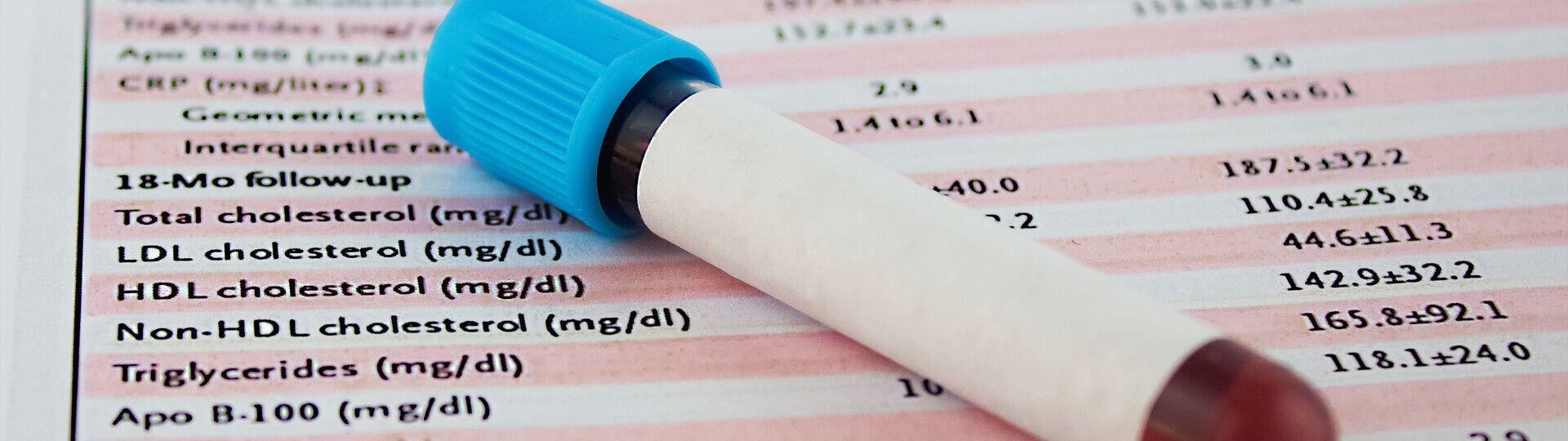 familiaere-hypercholesterinaemie-diagnose-behandlung-1130755944_H