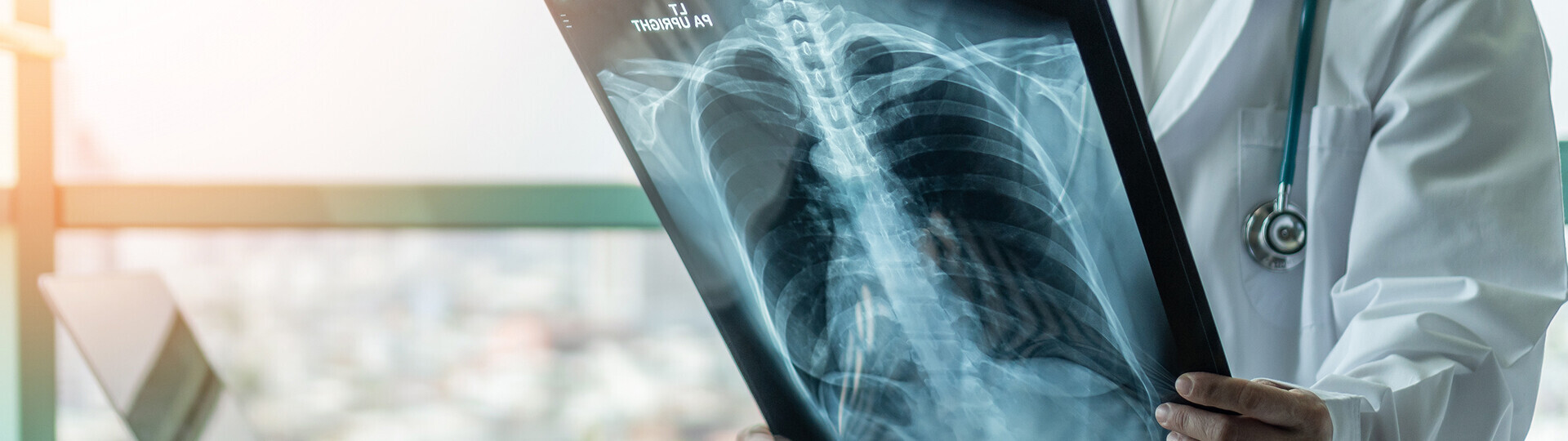 pneumokokken-23296290-h