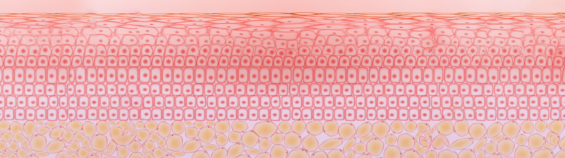 xanthome-haut-fett-cholesterin-1497794428-h