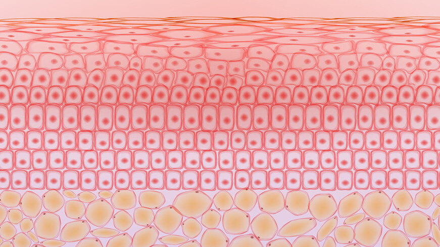 xanthome-haut-fett-cholesterin-1497794428-t3