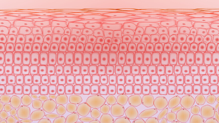 xanthome-haut-fett-cholesterin-1497794428-t3