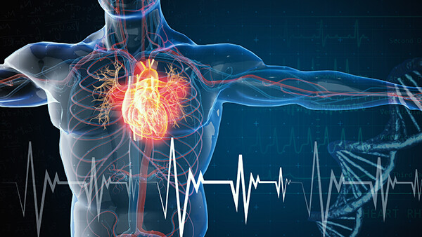 score2-risiko-herz-krankheit-1210336572-t