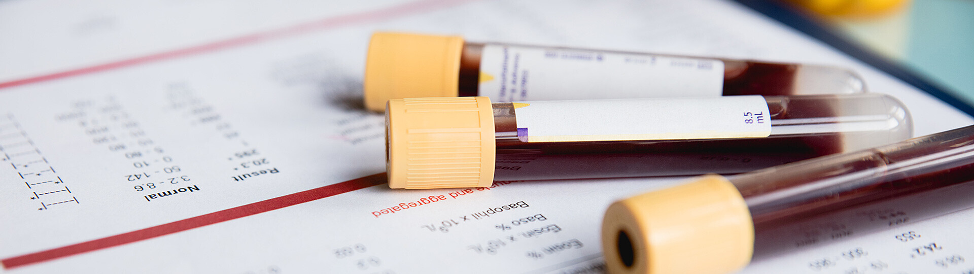 cholesterin-1183370025-h