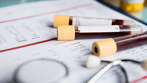 cholesterin-1183370025-t