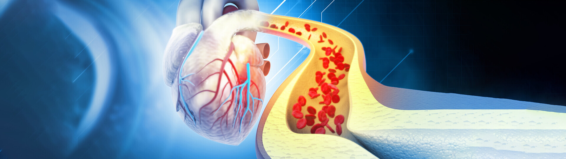 verkalkung-blutgefaesse-1457623083_Header