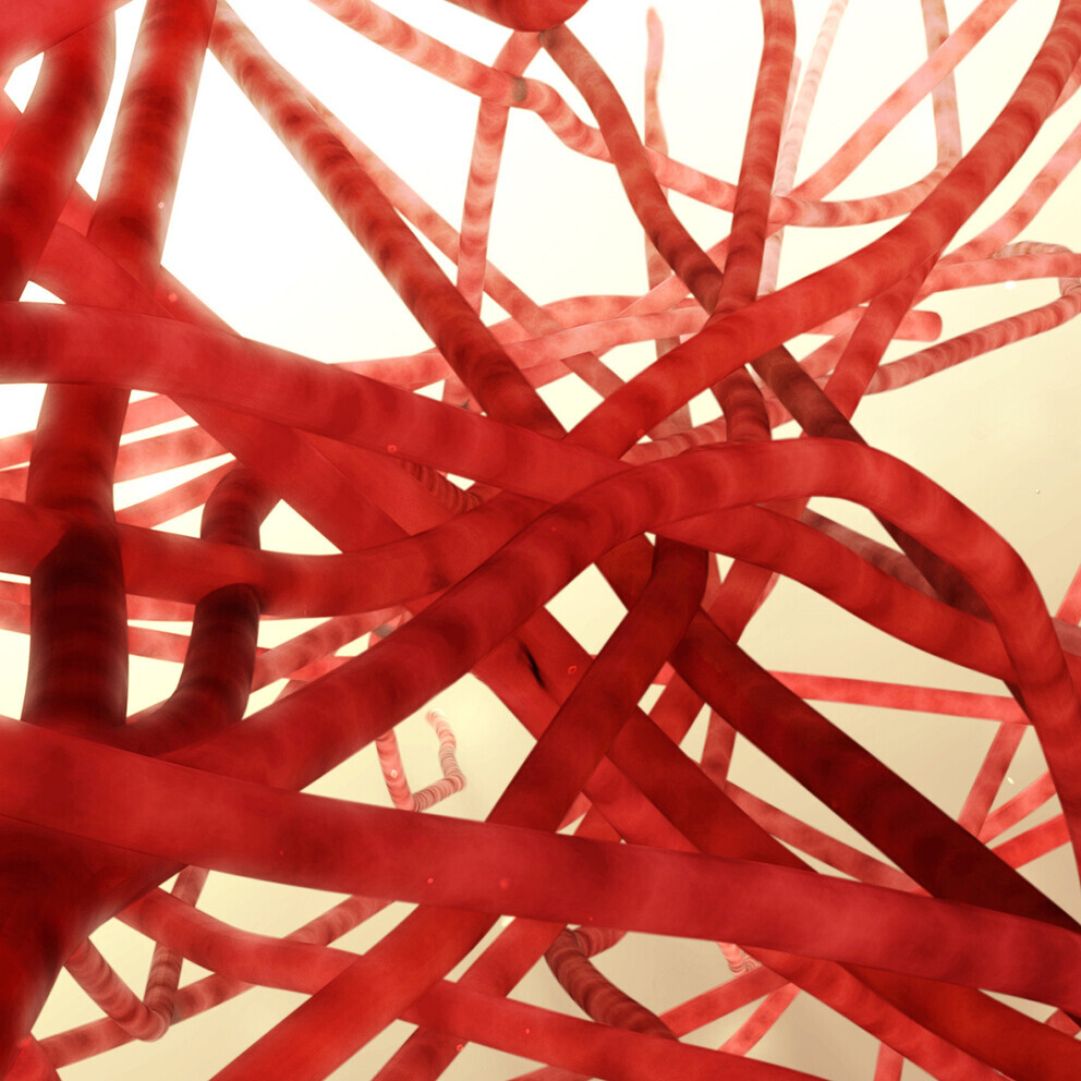angiologie-956478340_Header