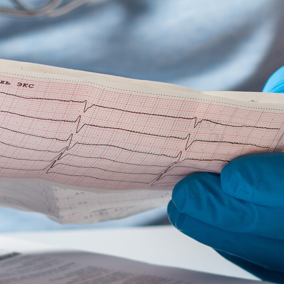 arrhythmie-1525365024_Header