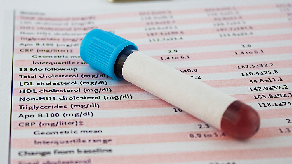 Familiäre Hypercholesterinämie: Diagnose, Behandlung