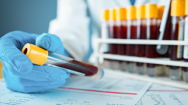 Was ist eine familiäre Hypercholesterinämie?