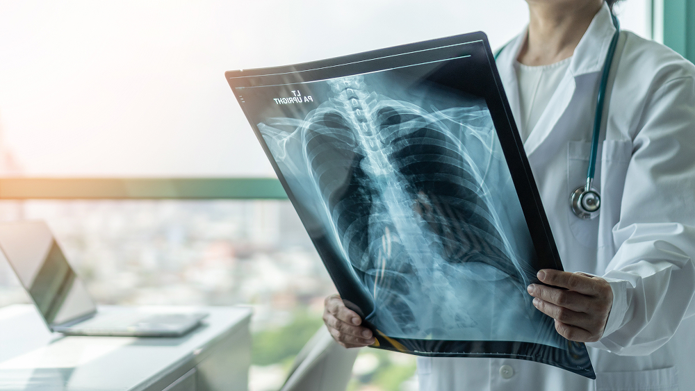Pneumokokken – die unterschätzte Gefahr fürs Herz