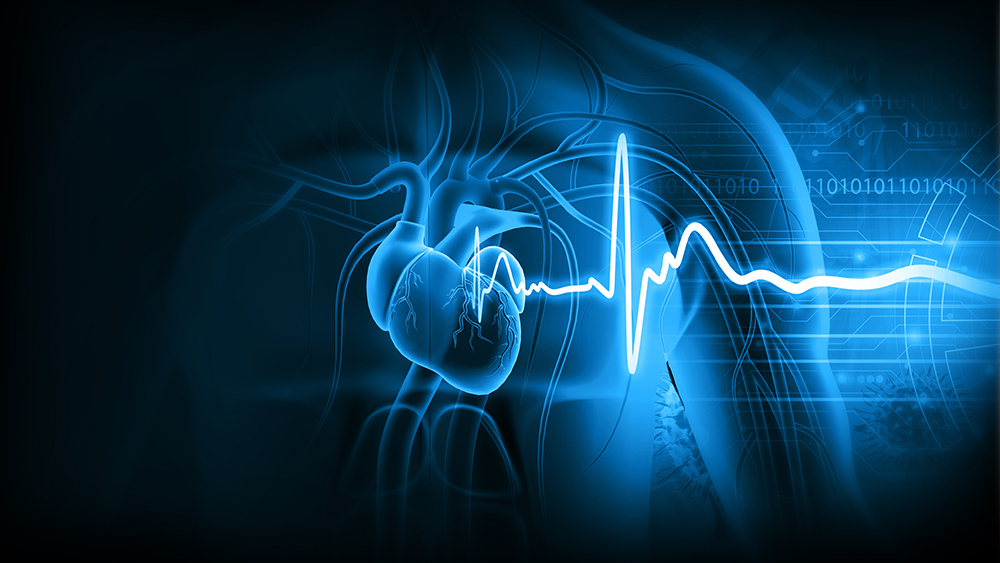 Sick-Sinus-Syndrom führt zu Herzrhythmusstörungen